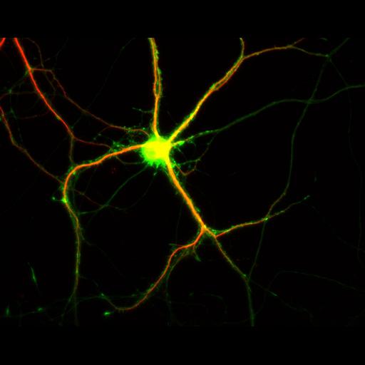 multipolar neuron