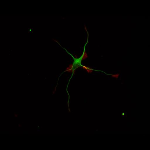 multipolar neuron