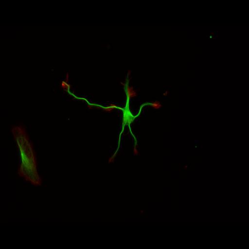 multipolar neuron