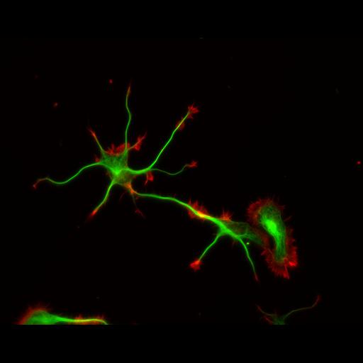 multipolar neuron