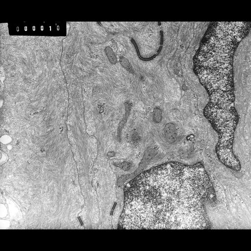 barrier epithelial cell