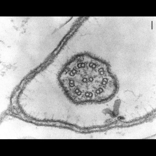 eukaryotic cell