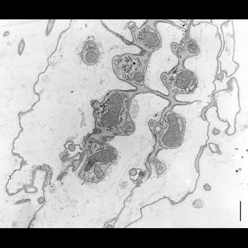 eukaryotic cell