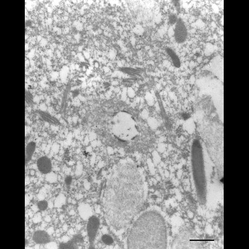 eukaryotic cell