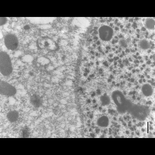 eukaryotic cell