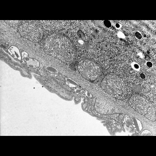 eukaryotic cell